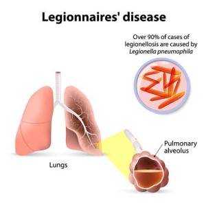 Legionnaires’ Disease Outbreak